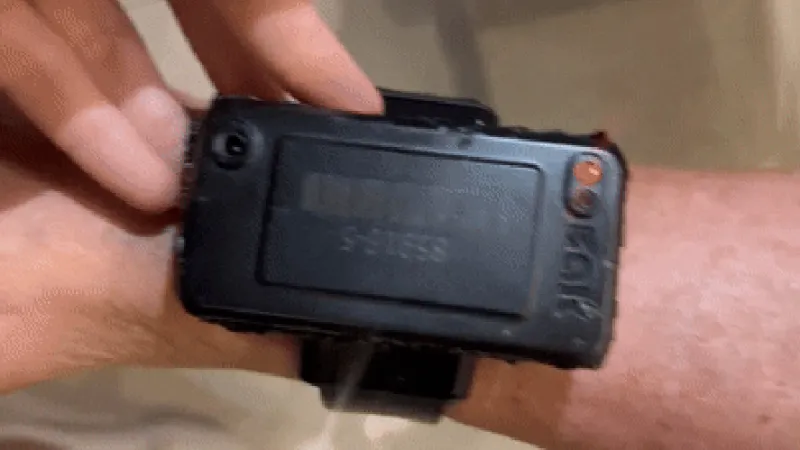 PF conclui que Bolsonaro tentou abrir tornozeleira eletrônica com fonte de calor