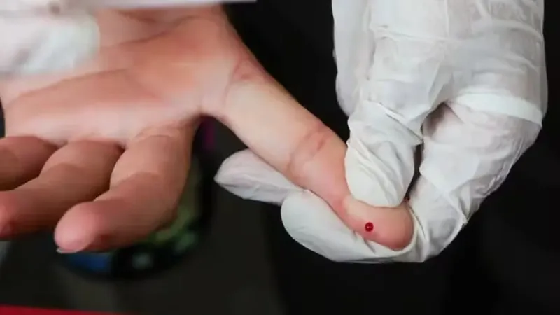 Brasil elimina transmissão vertical do HIV e registra menor mortalidade em anos