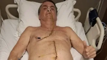 Conselho de medicina vai apurar autorização de entrada de pessoas em UTI de Bolsonaro