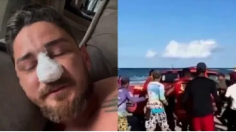 Turista agredido em Porto de Galinhas passa por cirurgia para corrigir fraturas