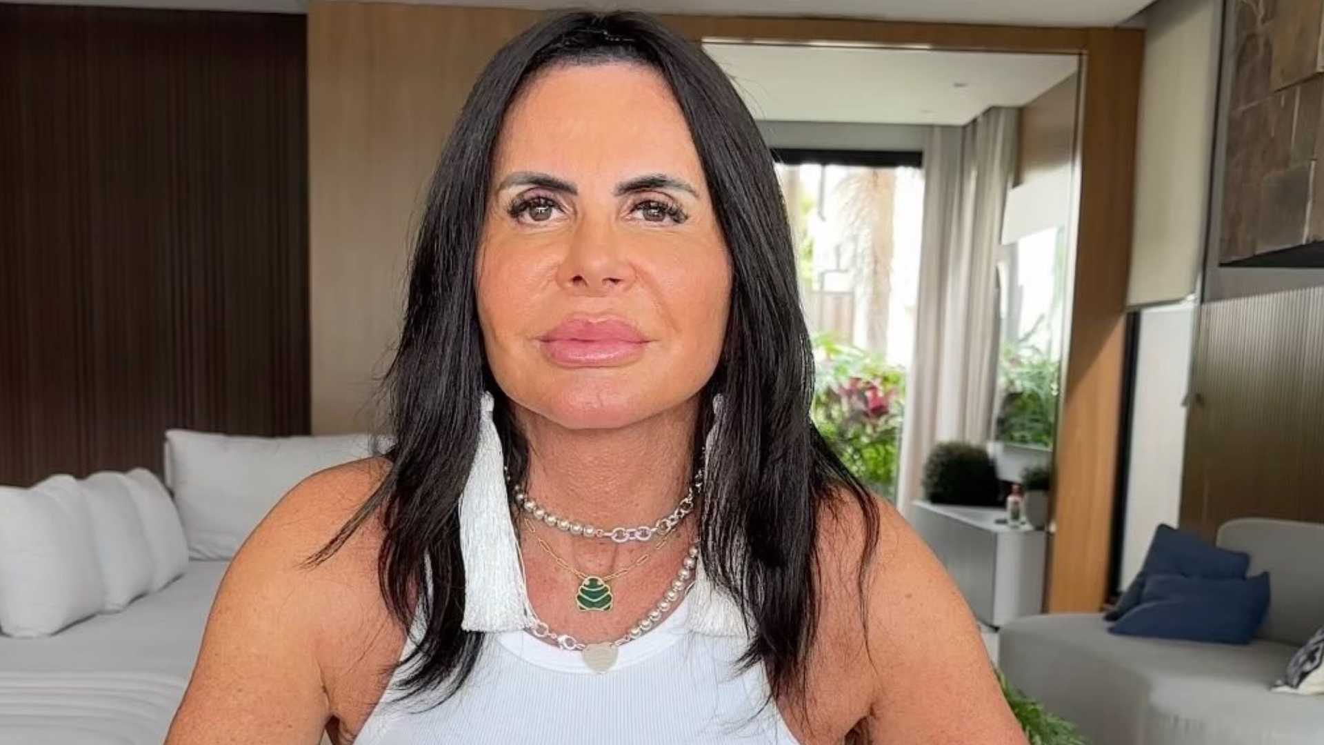 Gretchen rebate críticas por decidir realizar transplante capilar: ‘O que você tem a ver?’