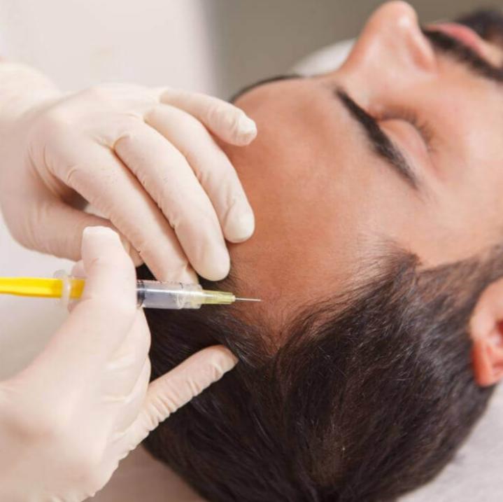 Homens buscam cada vez mais procedimentos estéticos para tratar a calvície