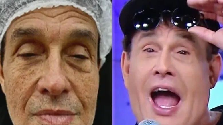Sérgio Mallandro faz sua terceira harmonização facial: ‘Eu queria parecer com o Tom Cruise’