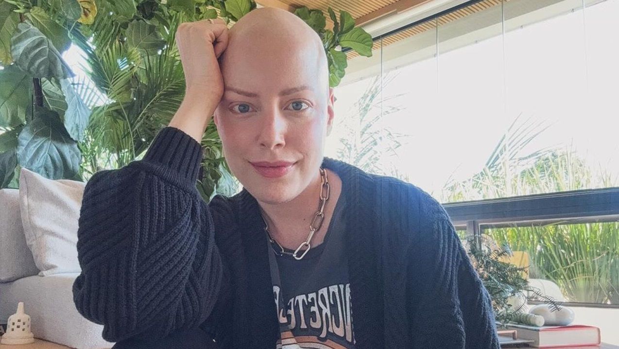 Fabiana Justus conta que perdeu as digitais após tratamento contra câncer: ‘Bizarro’