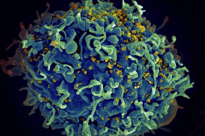 HIV/Aids: descobertas mostram que cura e vacina podem estar próximas
