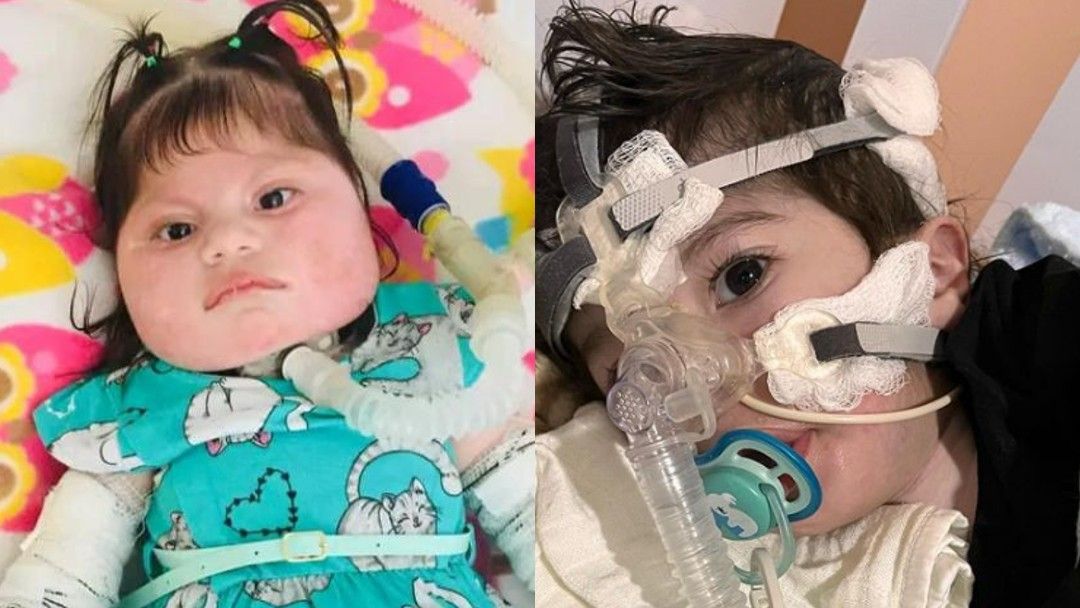 Crianças com AME morrem à espera de medicamento ‘mais caro do mundo’