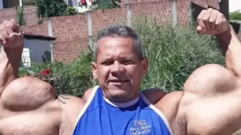 Morre Arlindo de Souza, conhecido como "Popeye Brasileiro"