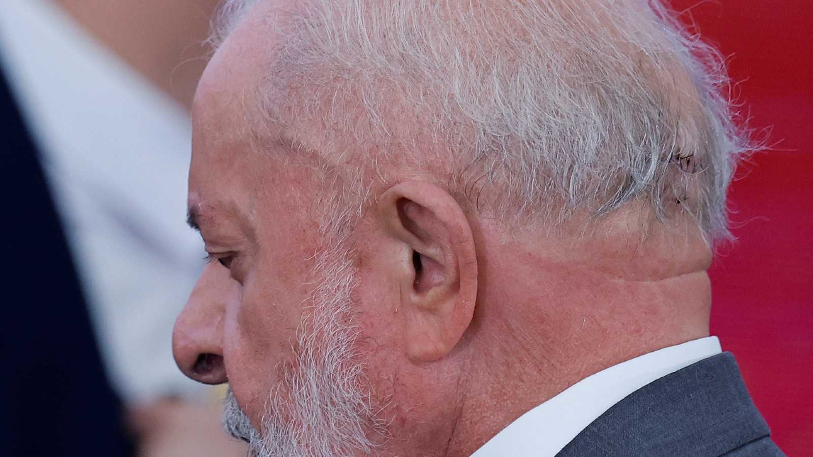 ‘Procedimento foi um sucesso’, diz Kalil sobre nova cirurgia de Lula