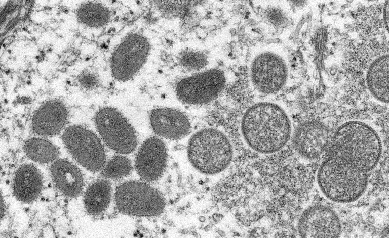 Qual a taxa de mortalidade da mpox? Veja a comparação com outras doenças virais