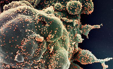 Covid-19: SP tem dois casos identificados da variante Ômicron XQ