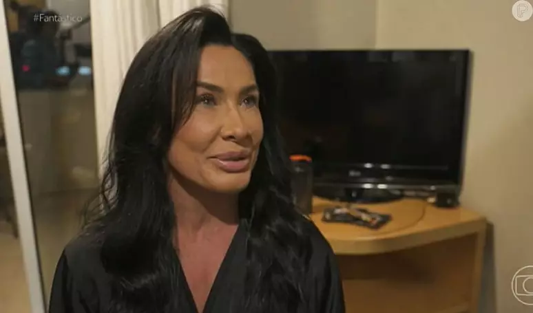 Aparência 'toda esticada' de Scheila Carvalho choca a web após entrevista na TV: 'Igual a Gretchen'
