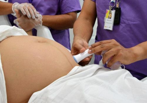 Sesau promove Fórum Perinatal nesta quinta-feira para discutir avanços na atenção materna e infantil