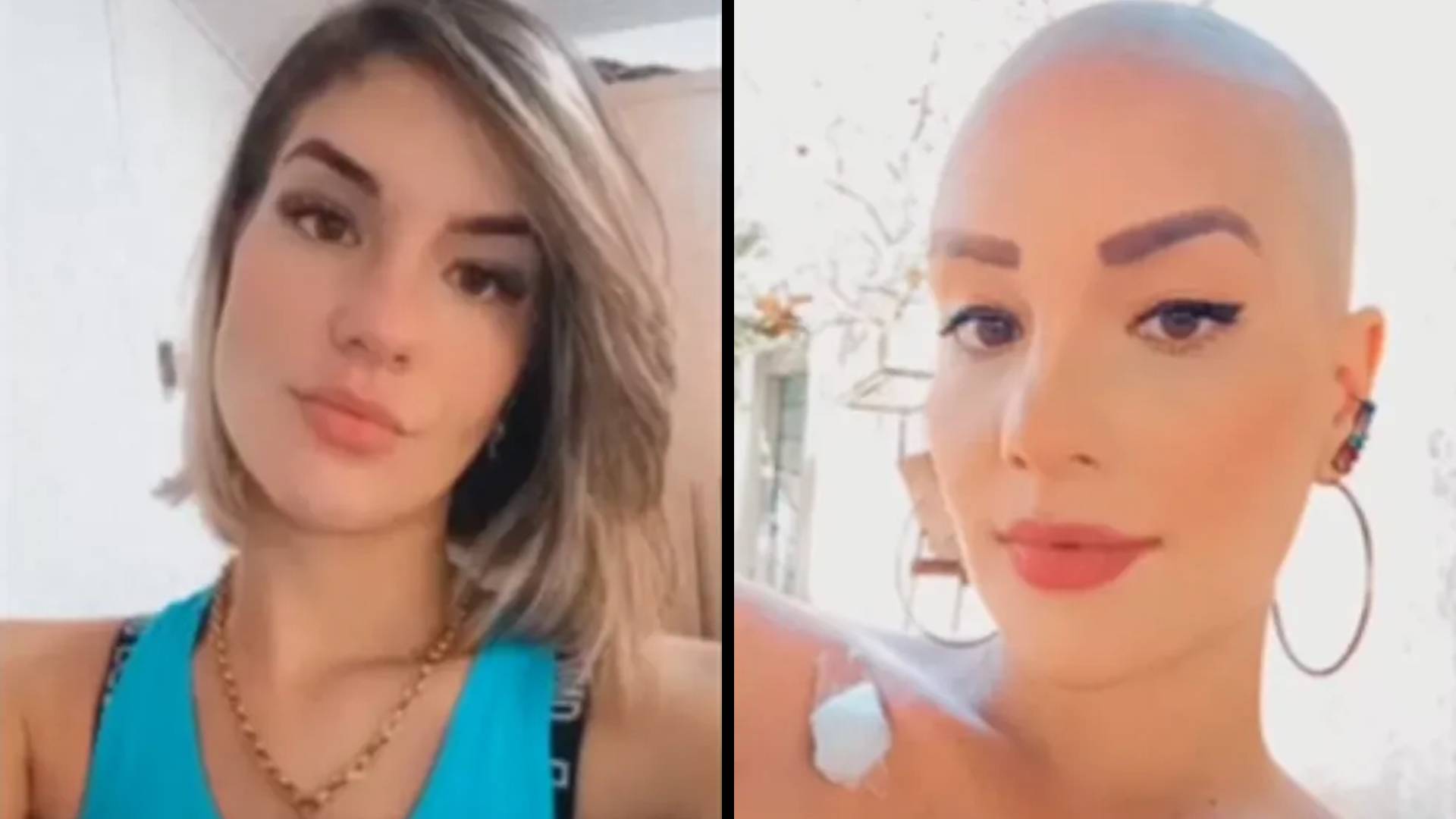 Mulher arrecada R$ 20 mil em doações após fingir ter câncer