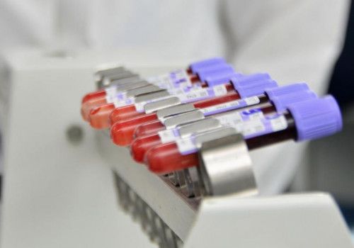 Hemoal cadastra doadores de medula óssea no Cesmac nesta sexta (15)