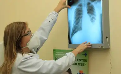 Brasil está na contramão da meta da OMS para extinção da tuberculose