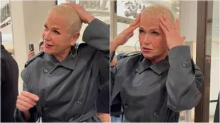 Xuxa mostra evolução do transplante capilar: ‘Tá crescendo’