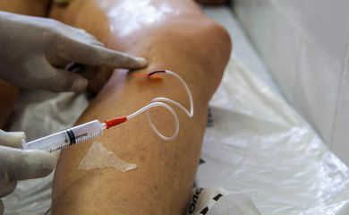A cada dia, 145 mulheres são internadas para tratar varizes