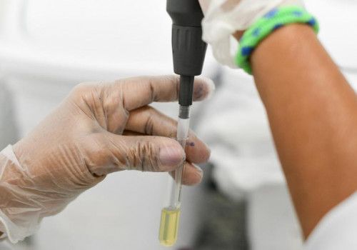 Hemoal realiza nesta quarta cadastro para doação de medula óssea no Ifal Maceió