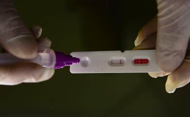 Brasil registra 27.796 casos de covid-19 e 114 mortes