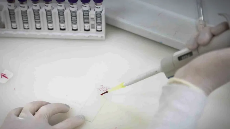 Exames descartam ebola em imigrante da República Democrática do Congo
