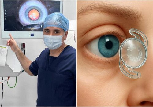 Professor da Uncisal lidera criação de lente para catarata aprovada pela Anvisa 