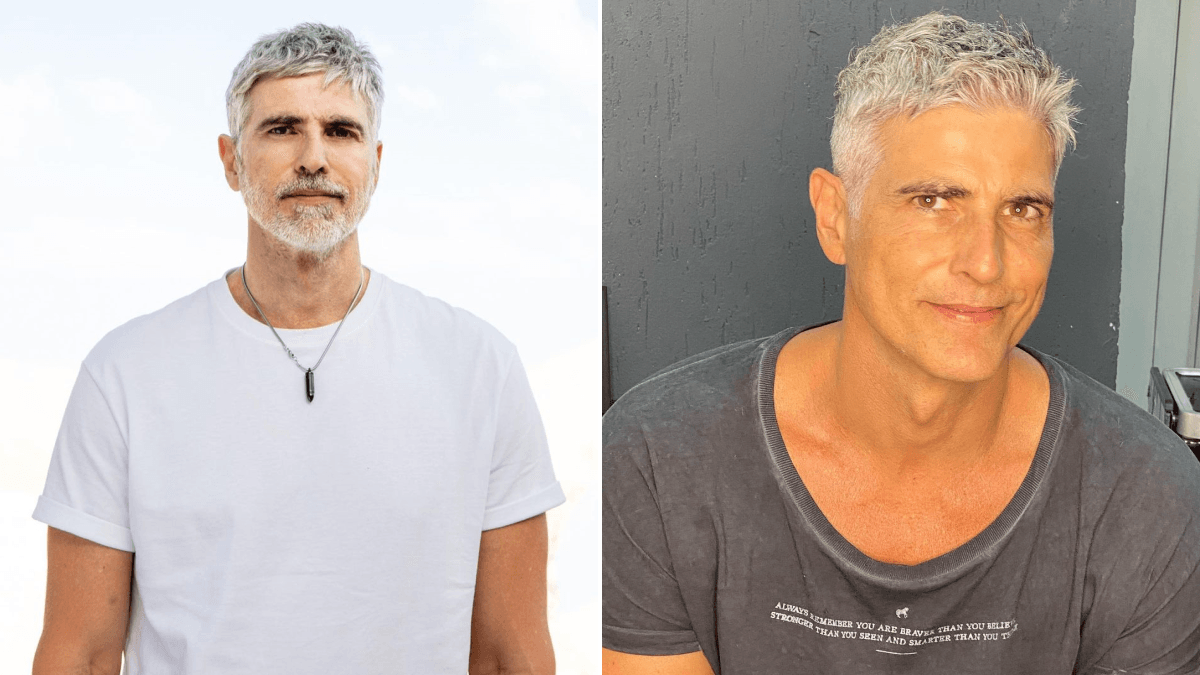 Reynaldo Gianecchini faz rejuvenescimento facial
