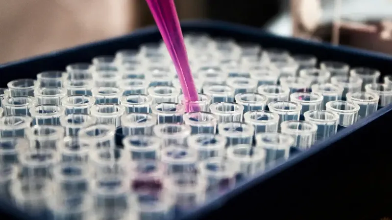 Pesquisas brasileiras avançam no diagnóstico de Alzheimer