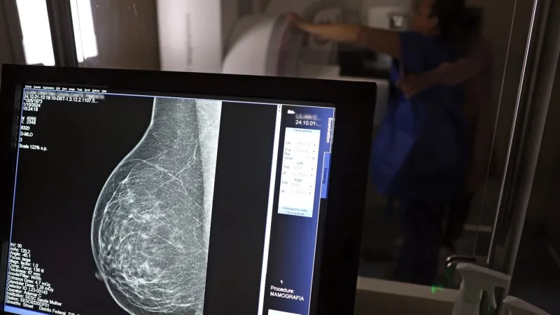 Médicos lançam guia para evitar recusa de mamografia digital