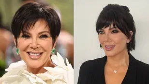 Lifting facial: como funciona a cirurgia que rejuvenesceu a mãe das Kardashians