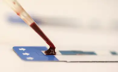 Unicef: maioria de jovens com HIV aprova acolhida em serviços de saúde