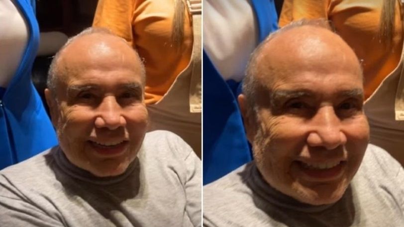 Stênio Garcia afirma que rosto está normal