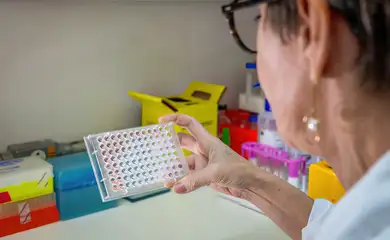 Butantan desenvolve teste que detecta leptospirose em estágio inicial