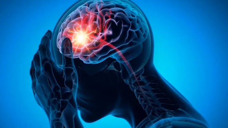 AVC: conheça sinais de alerta do derrame que exigem atenção imediata