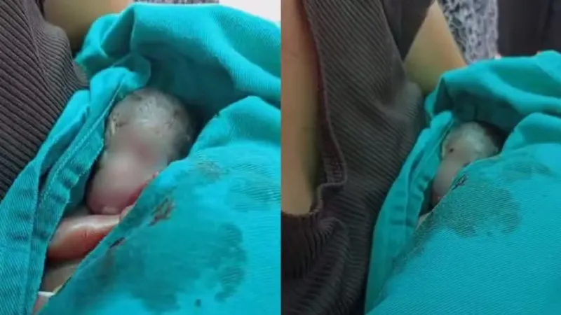 Recém-nascido dado como morto chora dentro do caixão durante sepultamento