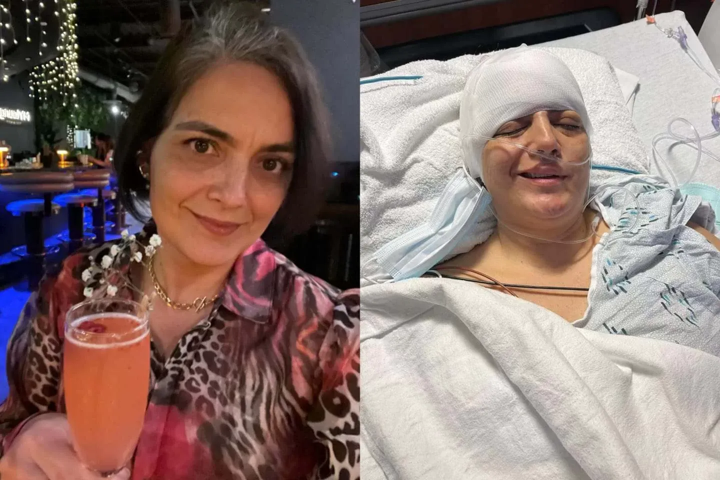 Mulher que teve câncer no cérebro 2 vezes alerta para sintoma ignorado