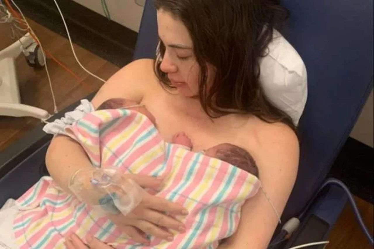 Mulher com dois úteros dá à luz gêmeos concebidos em dias diferentes