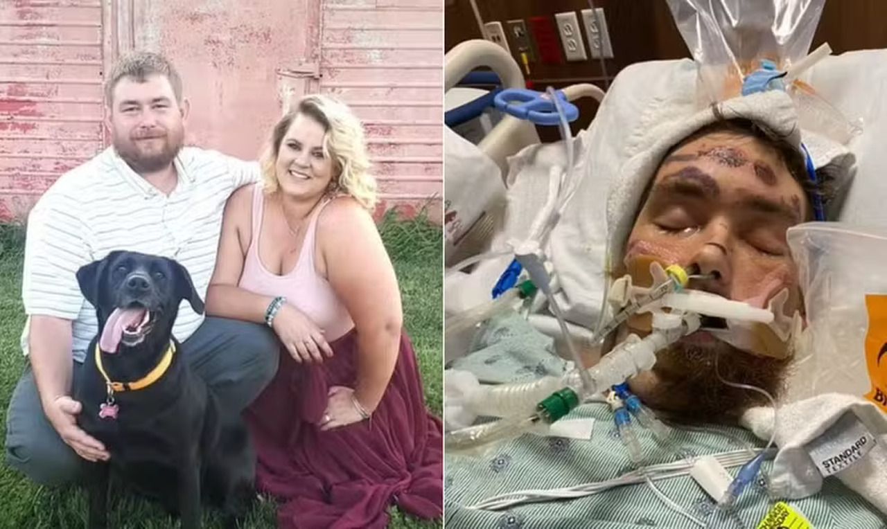 Homem é diagnosticado com infecção mortal depois de tentar remover pelo encravado da perna; entenda
