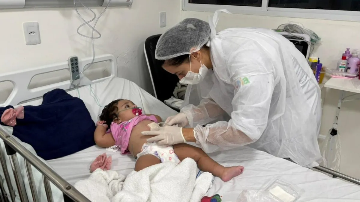 Enfermeiras do Hospital da Criança de Alagoas alertam sobre o que fazer em caso de queimaduras nas festas juninas