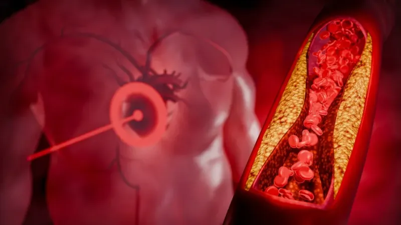 Alimento barato pode reduzir o colesterol em até 4 semanas, diz estudo