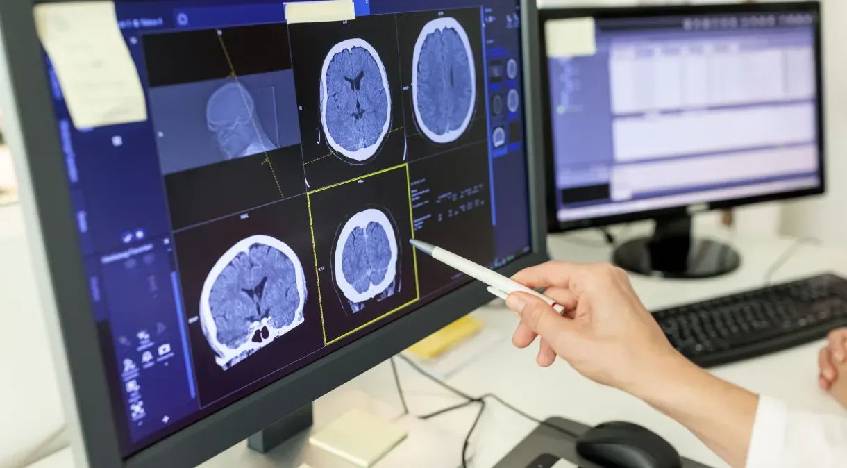 Estudo do Instituto Butantan testa tratamento contra Alzheimer baseado em molécula modificada do peixe merluza