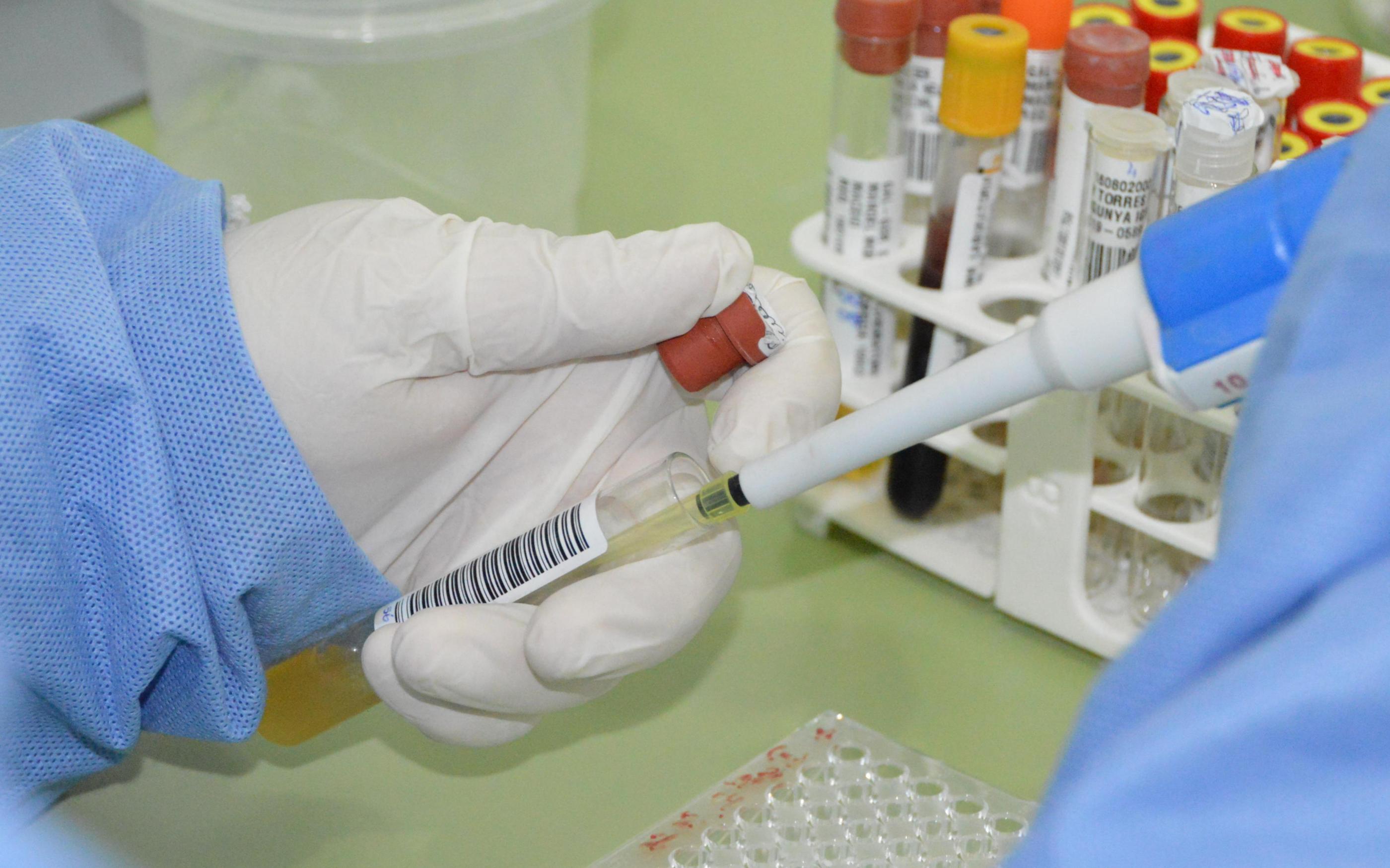 Com 7 casos este ano em Alagoas, Sesau reforça medidas de prevenção contra meningite