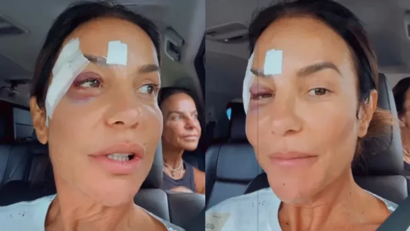 Ivete Sangalo deixa hospital e explica motivo de desmaio após diarreia