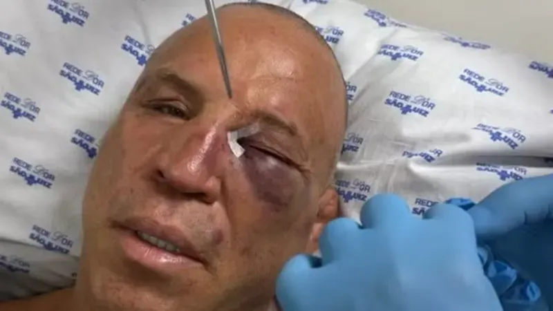 Autor de agressão a Wanderlei Silva é filho de Popó