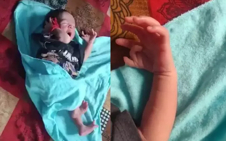 Bebê nasce com 26 dedos, e pais acreditam ser a encarnação de deusa indiana