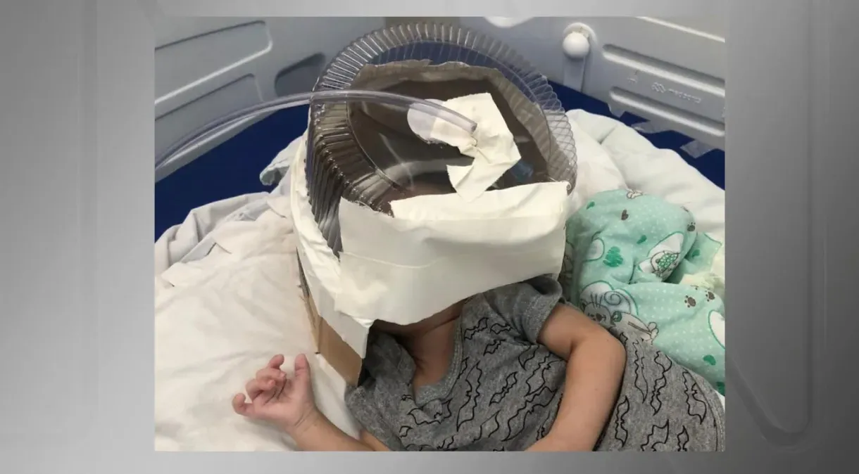 Bebê usa embalagem de bolo como máscara de oxigênio em hospital no RN