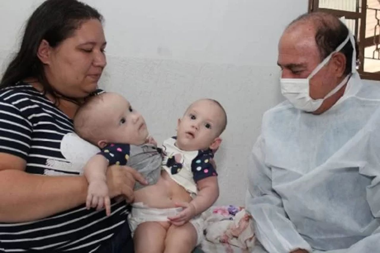 Siamesas separadas em Goiás recebem alta e mãe comemora: “Realizada”