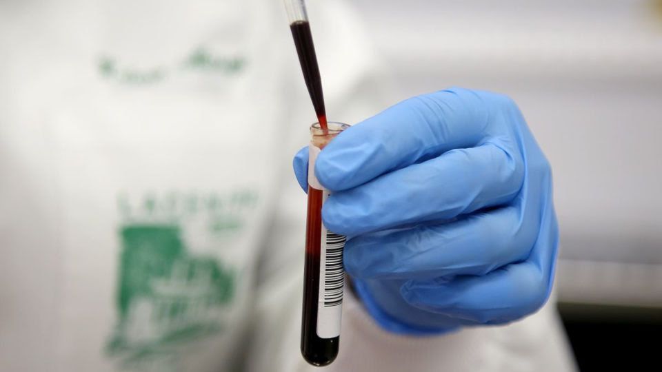 Variola dos macacos: OMS declara doença emergência de saúde global